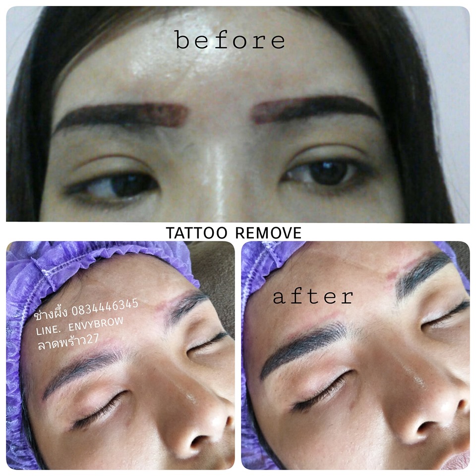 รีวิวลูกค้าสักคิ้วกับ Envybrow 4D Tattoo สักคิ้ว ลบคิ้ว แก้คิ้ว  