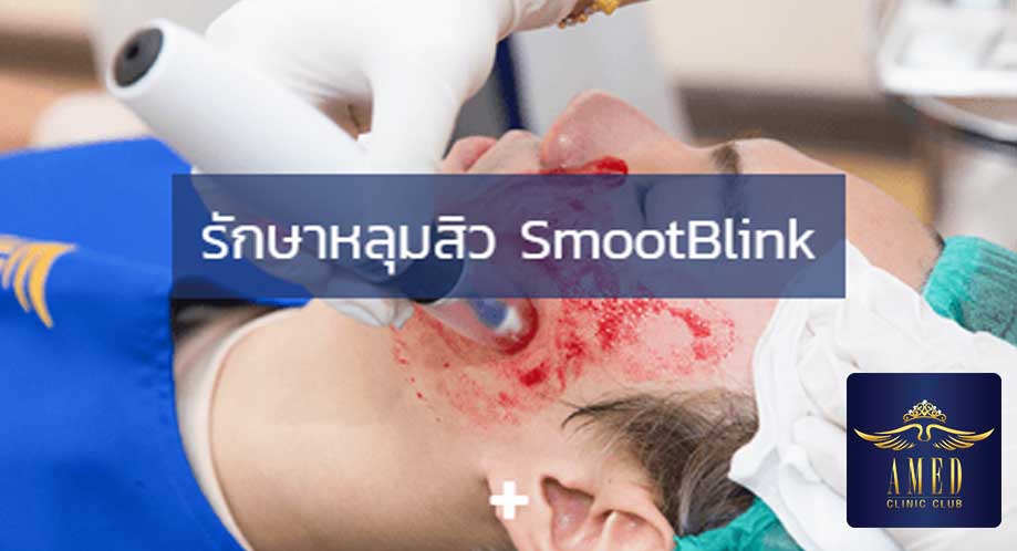 AMED Clinic-คลินิกเลเซอร์หลุมสิว