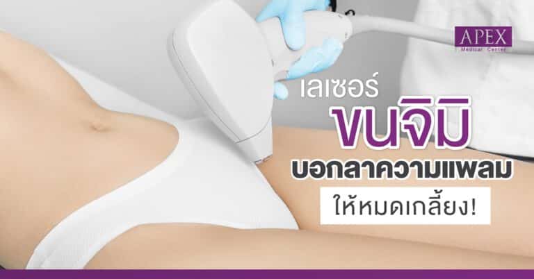 APEX Medical Center เลเซอร์ขนจิมิ บอกลาความแพลม เรียบเนียน