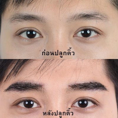 DRK Beauty Clinic คลินิกปลูกคิ้วถาวร - 2