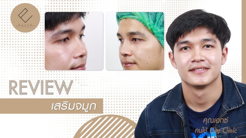 Elite Clinic คลินิกเสริมจมูกผู้ชาย - 2