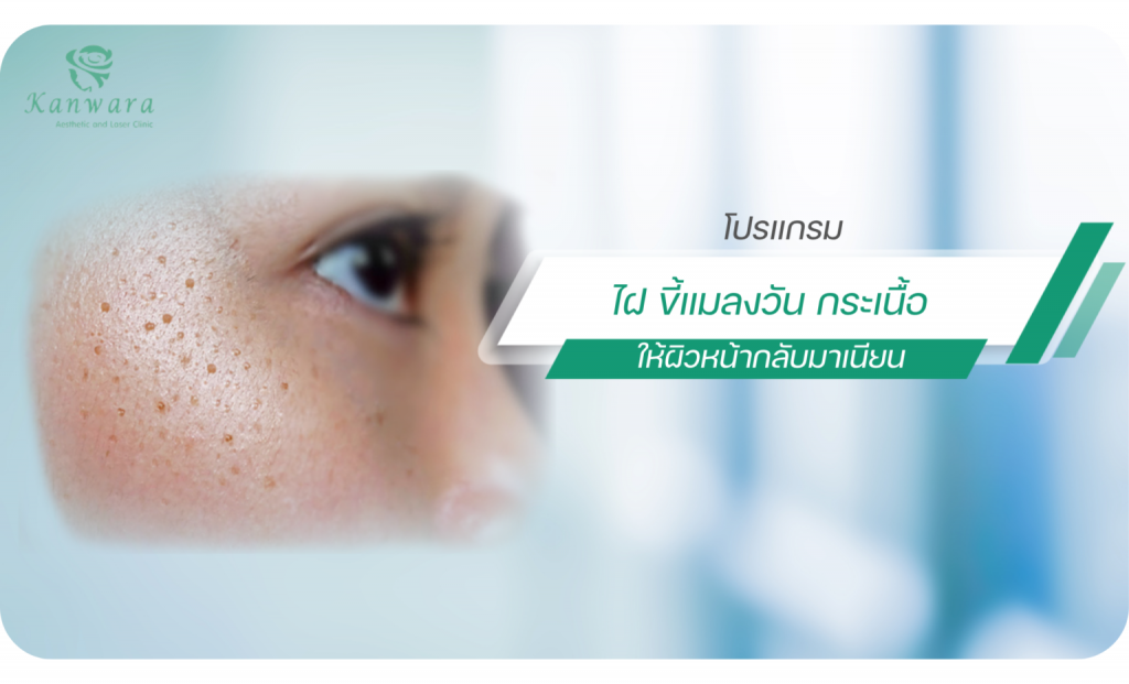 Kanwara Clinic บริการจี้ไฝ - 1