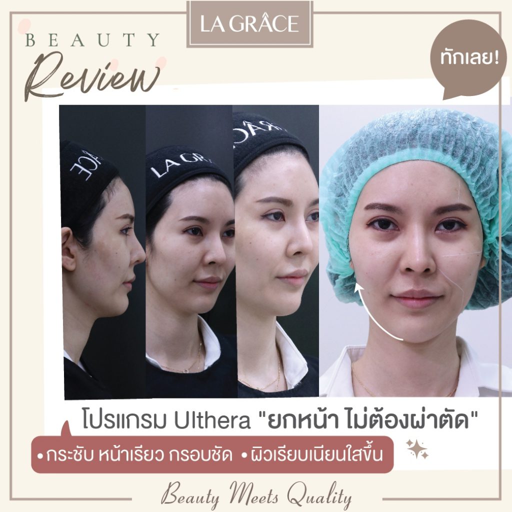 La Grace Clinic Ulthera ที่ดีที่สุด - 2