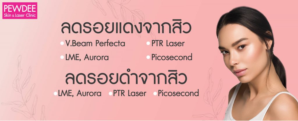 Pewdee Clinic บริการเลเซอร์ Vbeam - 1