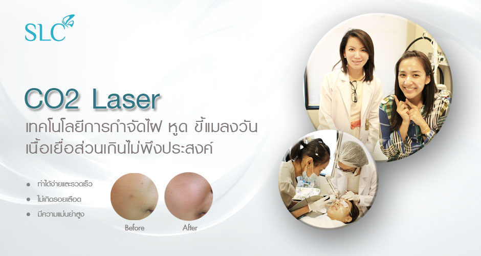 SLC Clinic คลินิกจี้ไฝ - 1