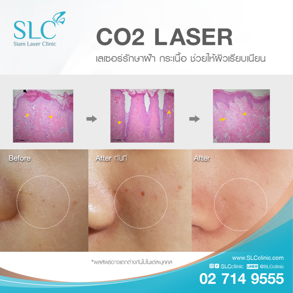 SLC Clinic คลินิกจี้ไฝ - 2