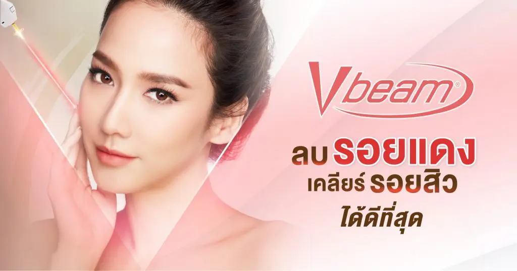 The Klinique เลเซอร์ Vbeam - 1