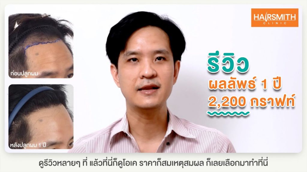 Hairsmith Clinic บริการปลูกผม - 1