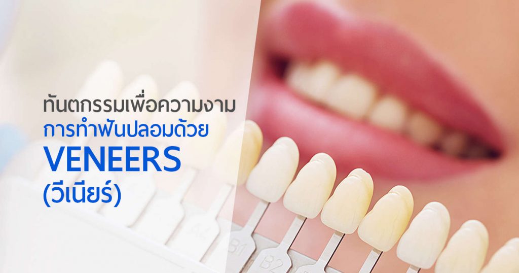 LDC Dental คลินิกทำวีเนียร์ - 1