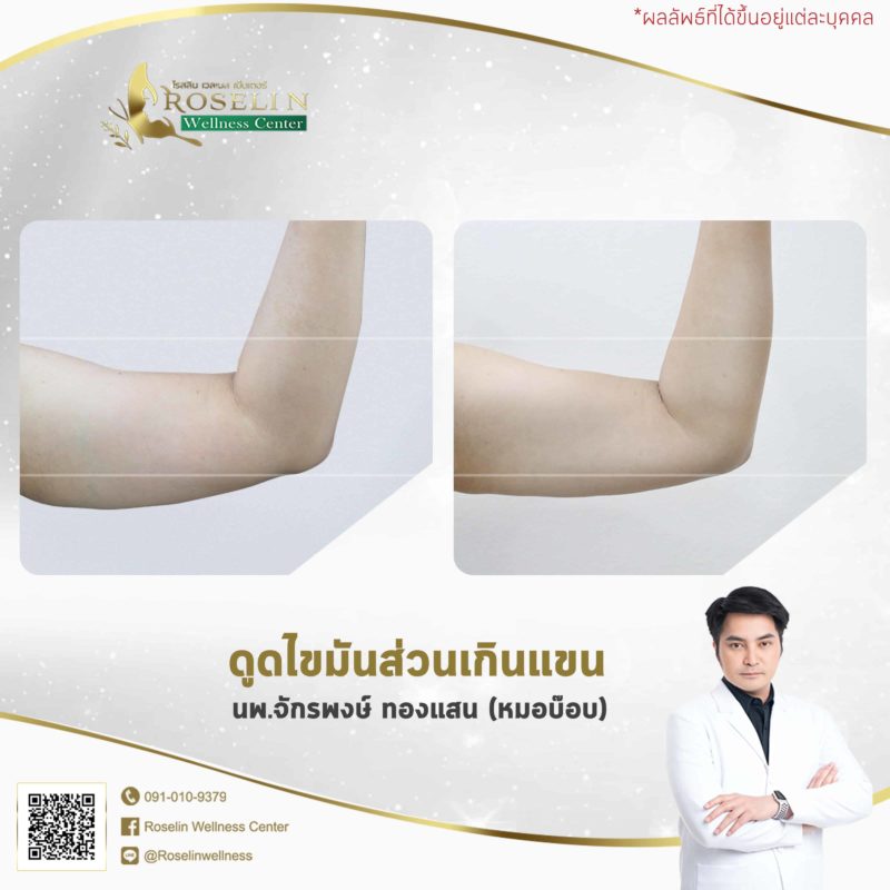 RWC Clinic คลินิกดูดไขมัน - 2