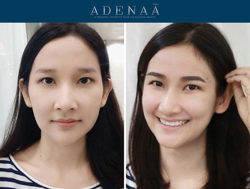 ADENAA Clinic คลินิกสักคิ้วสีฝุ่น - 2