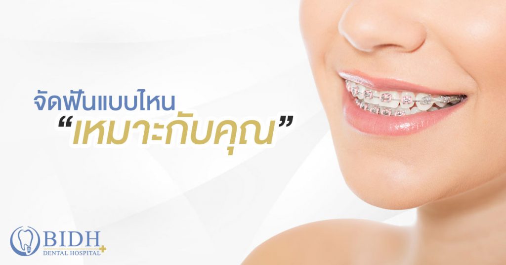 BIDH Dental Hospital จัดฟันแบบดามอน - 1