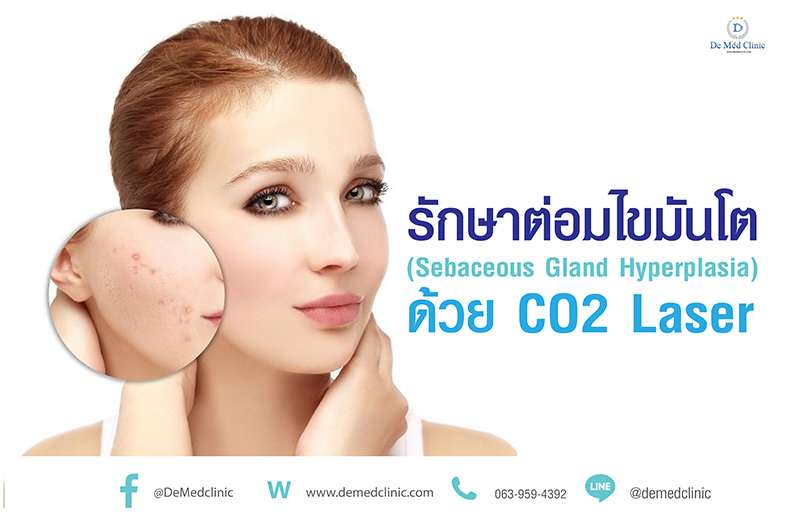 De Med Clinic คลินิกเลเซอร์ต่อมไขมัน - 1