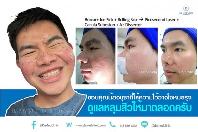 De Med Clinic คลินิกเลเซอร์ต่อมไขมัน - 2