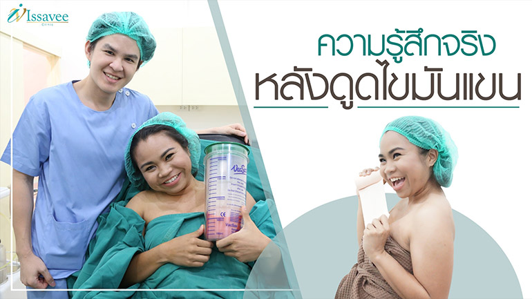 Issavee Clinic คลินิกดูดไขมัน - 1