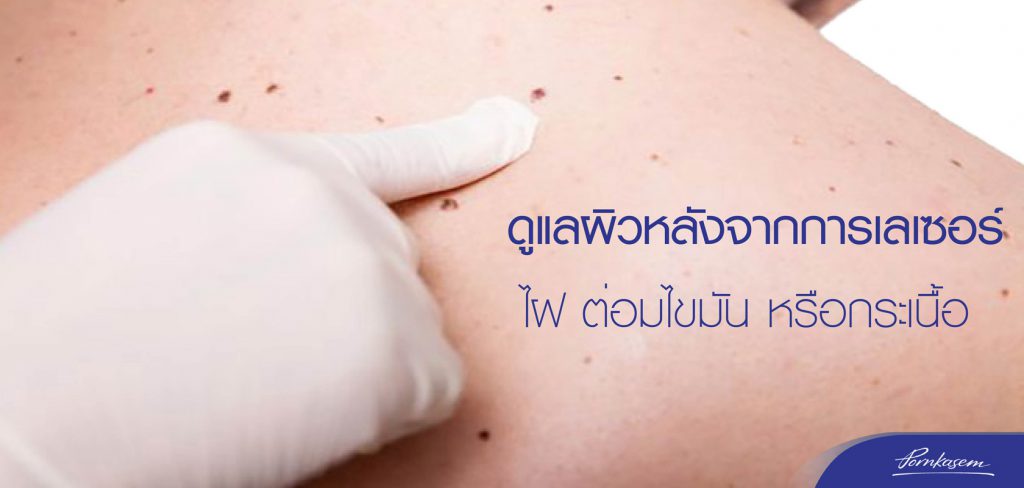 Pornkasem Clinic คลินิกเลเซอร์ต่อมไขมัน - 1