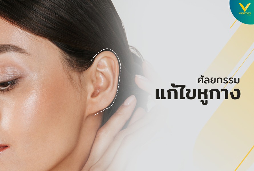 Vertex Clinic บริการแก้ไขหูกาง - 1