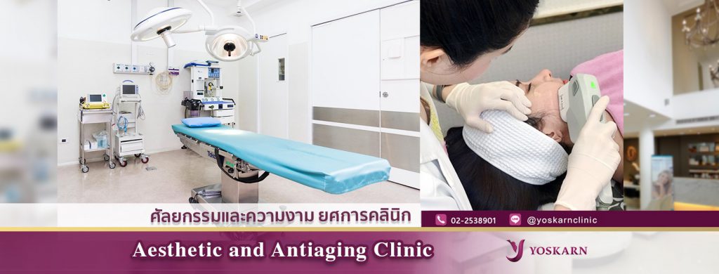 Yoskarn Clinic บริการเลเซอร์ปาน นวัตกรรมทันสมัยเลเซอร์ Q-Switch  - 1