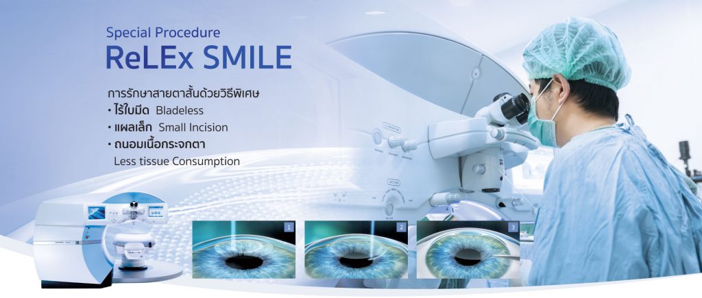 EENT Lasik Center บริการทำเลสิก ทุกเคสของสายตา รักษาหายได้ ภาพที่เห็นได้ชัดเจน