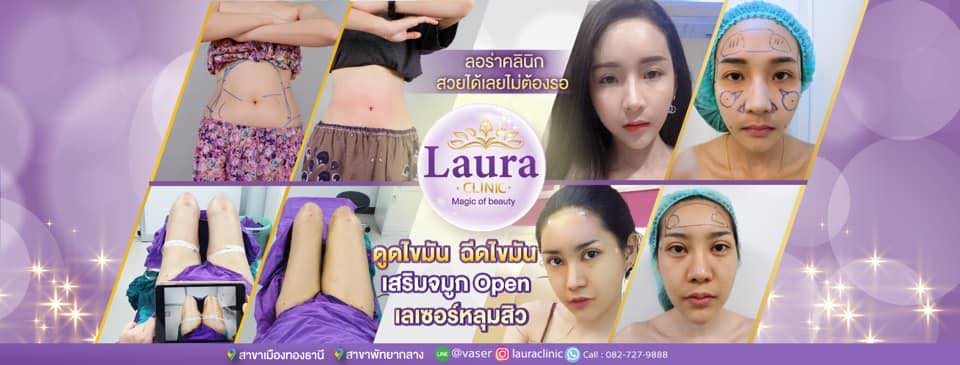 Laura Clinic คลินิกดูดไขมันต้นขา กระชับสัดส่วนต้นขา ผิวไร้ริวรอยหลังทำ - 1