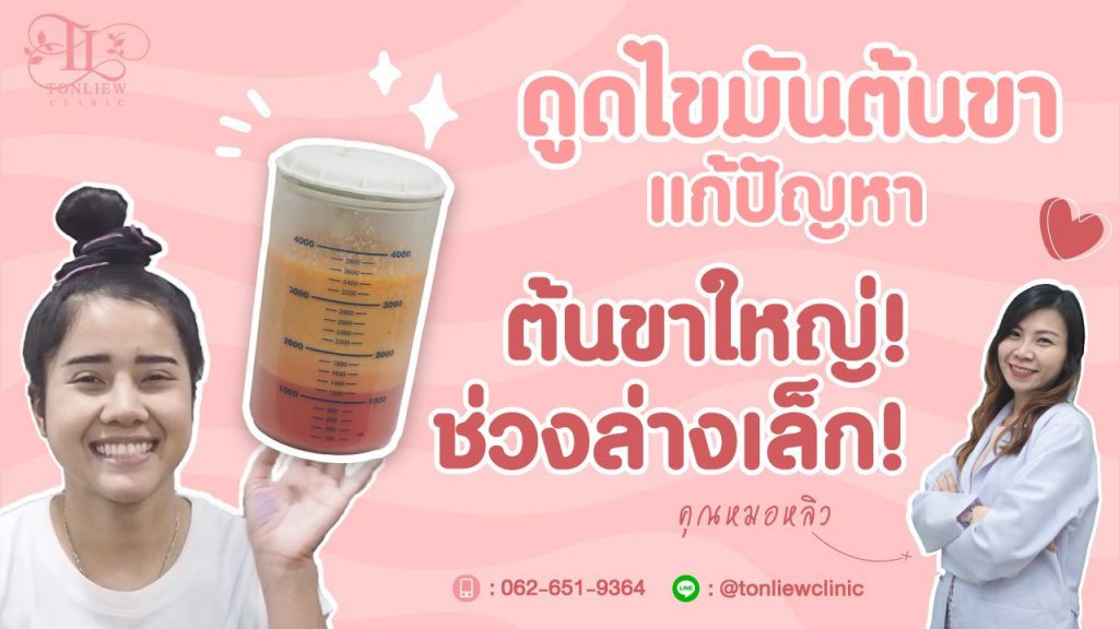 Tonliew Clinic บริการดูดไขมันต้นขา ปรึกษาทุกปัญหาของรูปร่างได้อย่างไม่ต้องกังวล - 1