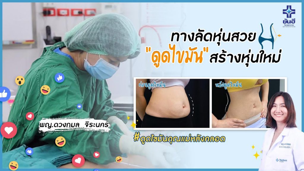 Yanhee Hospital ดูดไขมันเฉพาะส่วนที่ดีที่สุด ปรับสมดุลรูปร่าง ทีมแพทย์มืออาชีพ - 2