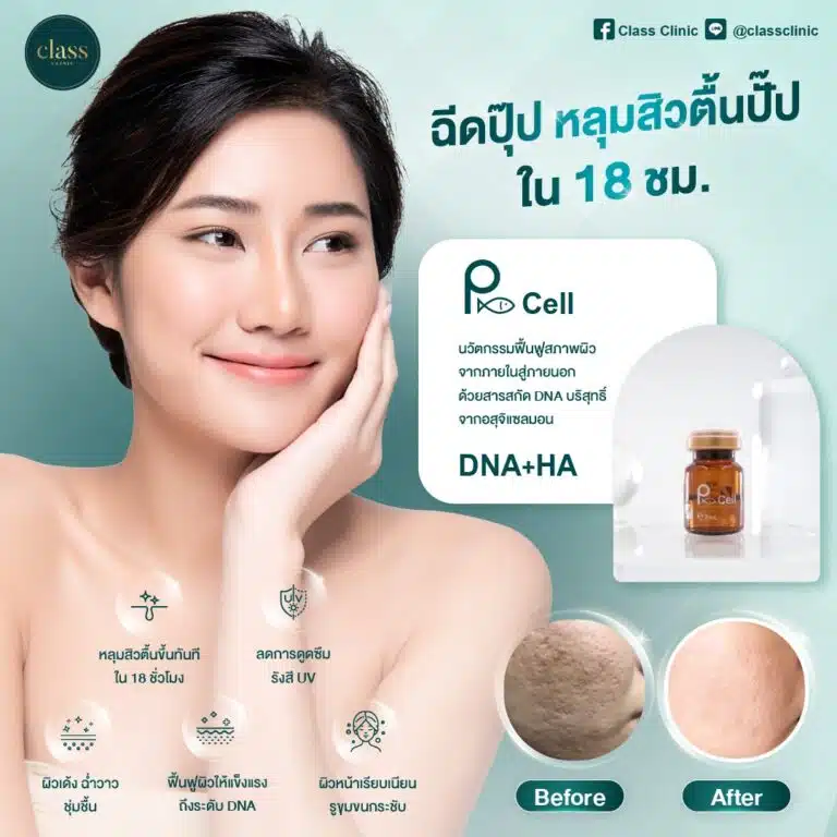 Class Clinic คลินิกรักษาสิว ฝ้า กระ ขอนแก่น ปรับผิวสวย สร้างสมดุลให้ผิวได้อย่างปลอดภัย - 2