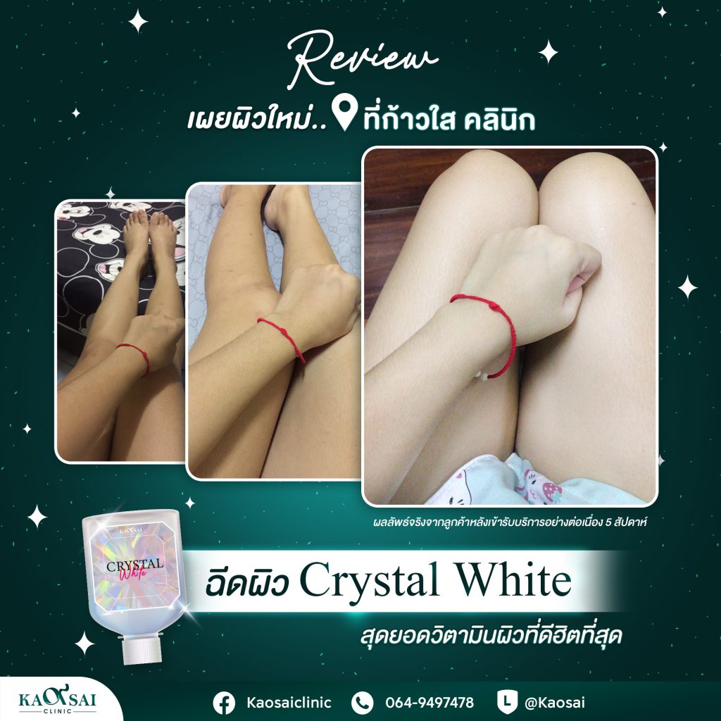 Kaosai Clinic คลินิกฉีดผิวขาว นครราชสีมา กระตุ้นผิวขาวผ่องใส ได้อย่างมั่นใจ - 2