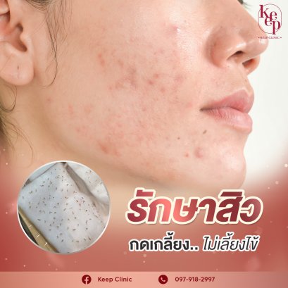 Keep Clinic บริการรักษาสิว ฝ้า กระ นครราชสีมา ดูแลทุกปัญหาของผิว รักษาหายได้ทุกเคสที่รับ - 2