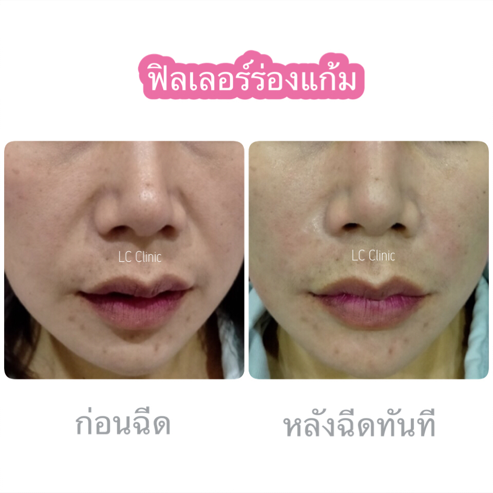 LC Clinic คลินิกฉีดฟิลเลอร์ นครราชสีมา บริการตามหลักเวชศาสตร์เสริมความงามชั้นนำ - 2