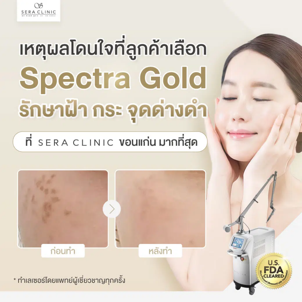 SERA Clinic คลินิกรักษาสิว ฝ้า กระ ขอนแก่น เทคนิคของแพทย์ผู้เชี่ยวชาญจากเกาหลี - 2