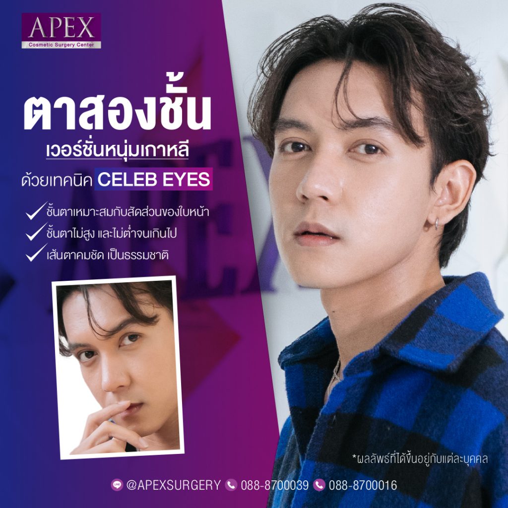 Apex Medical Center ศูนย์ทำตาสองชั้นผู้ชาย เปลี่ยนลุคเก่าเป็นลุคใหม่ หนุ่มตาใสสไตล์เกาหลี - 2