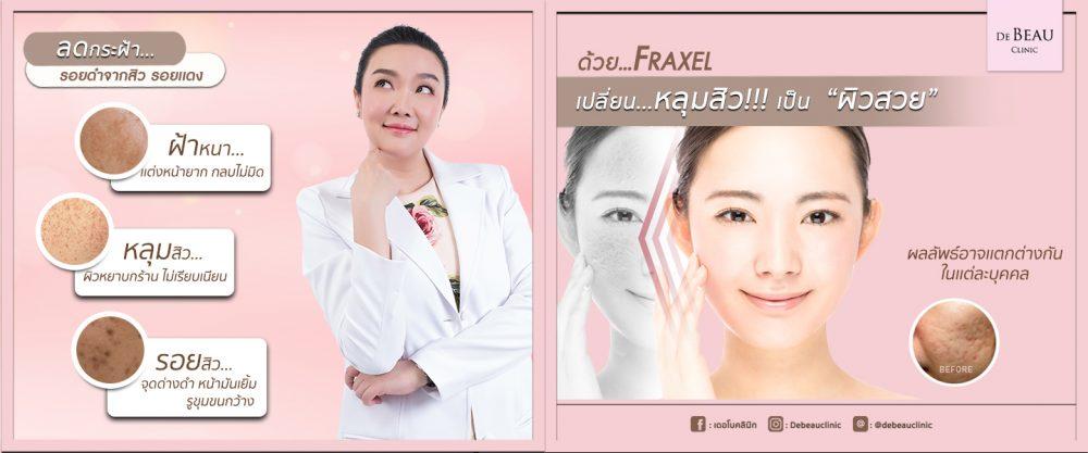 De Beau Clinic บริการเลเซอร์ผิวขาว กระตุ้นคอลลาเจน ลดผิวหมองคล้ำ ผิวเนียนเป็นธรรมชาติ - 2