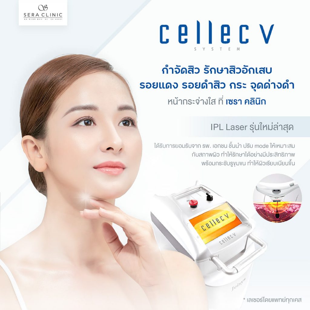 SERA Clinic บริการเลเซอร์ผิวขาว ปรับสมดุลให้ผิว เพิ่มความขาวกระจ่างใส เลเซอร์รุ่นล่าสุด - 2