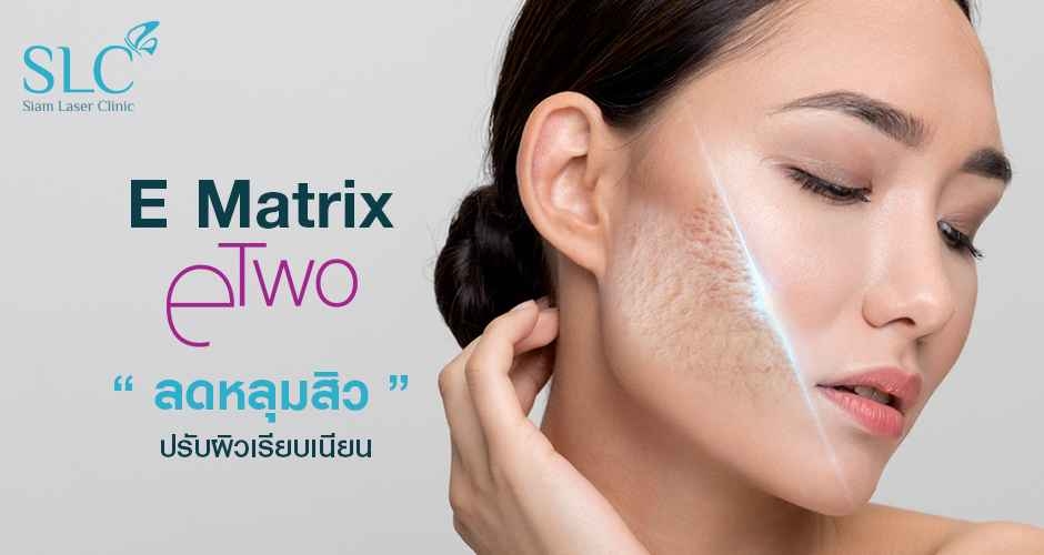 SLC Clinic รับทำ eMatrix ปรับลดริ้วรอยของผิวหน้า ปรับสมดุลผิวให้ดีกว่าเดิม - 1