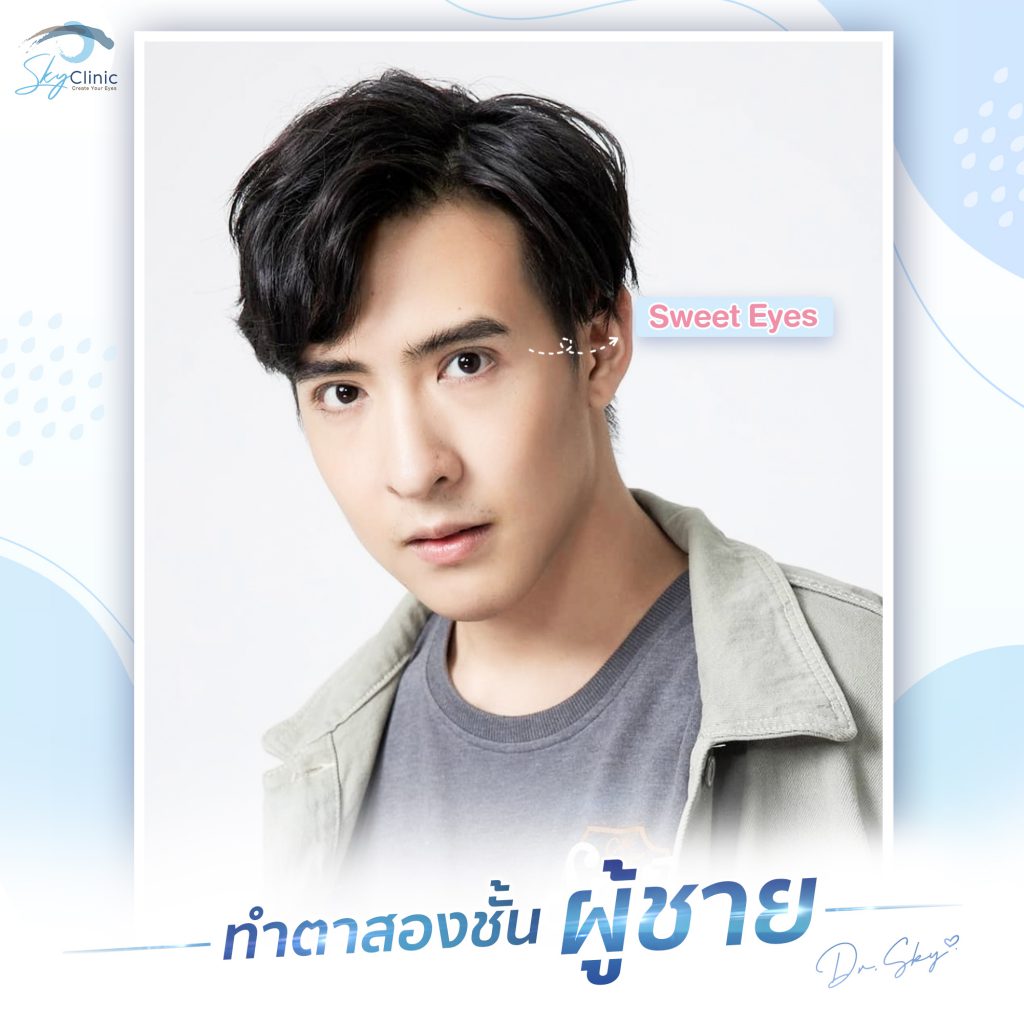 Sky Clinic รับทำตาสองชั้นผู้ชาย ปรับดวงตาตี๋ ให้กลมโต สดใส เพิ่มโหงวเฮ้งดียิ่งขึ้น - 2