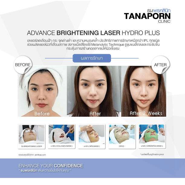 Tanaporn Clinic เลเซอร์ผิวขาว เผยผิวขาว กระจ่างใสได้อย่างมั่นใจ - 2