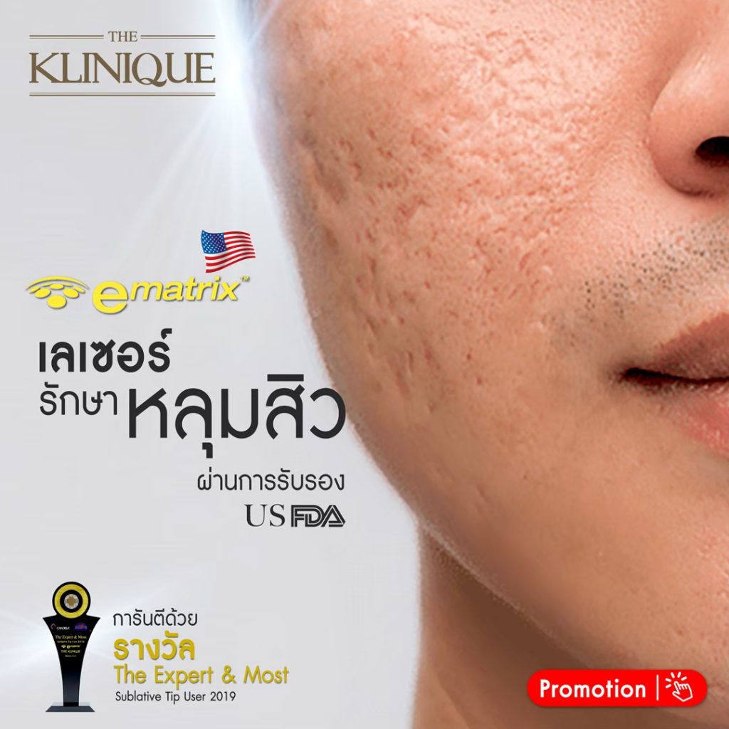 The Klinique Clinic บริการทำ eMatrix ลดริ้วรอยผิว เสริมการฟื้นฟูเซลล์ให้ดีมากขึ้น - 2