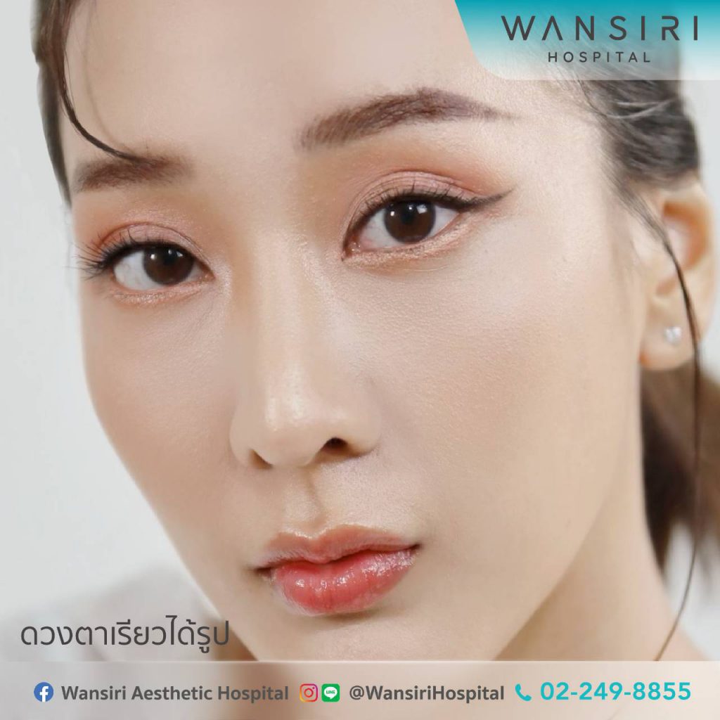 Wansiri Hospital บริการศัลยกรรมดอลลี่อาย เนรมิตความฝันของดวงตาสวยใสได้อย่างมั่นใจ - 2