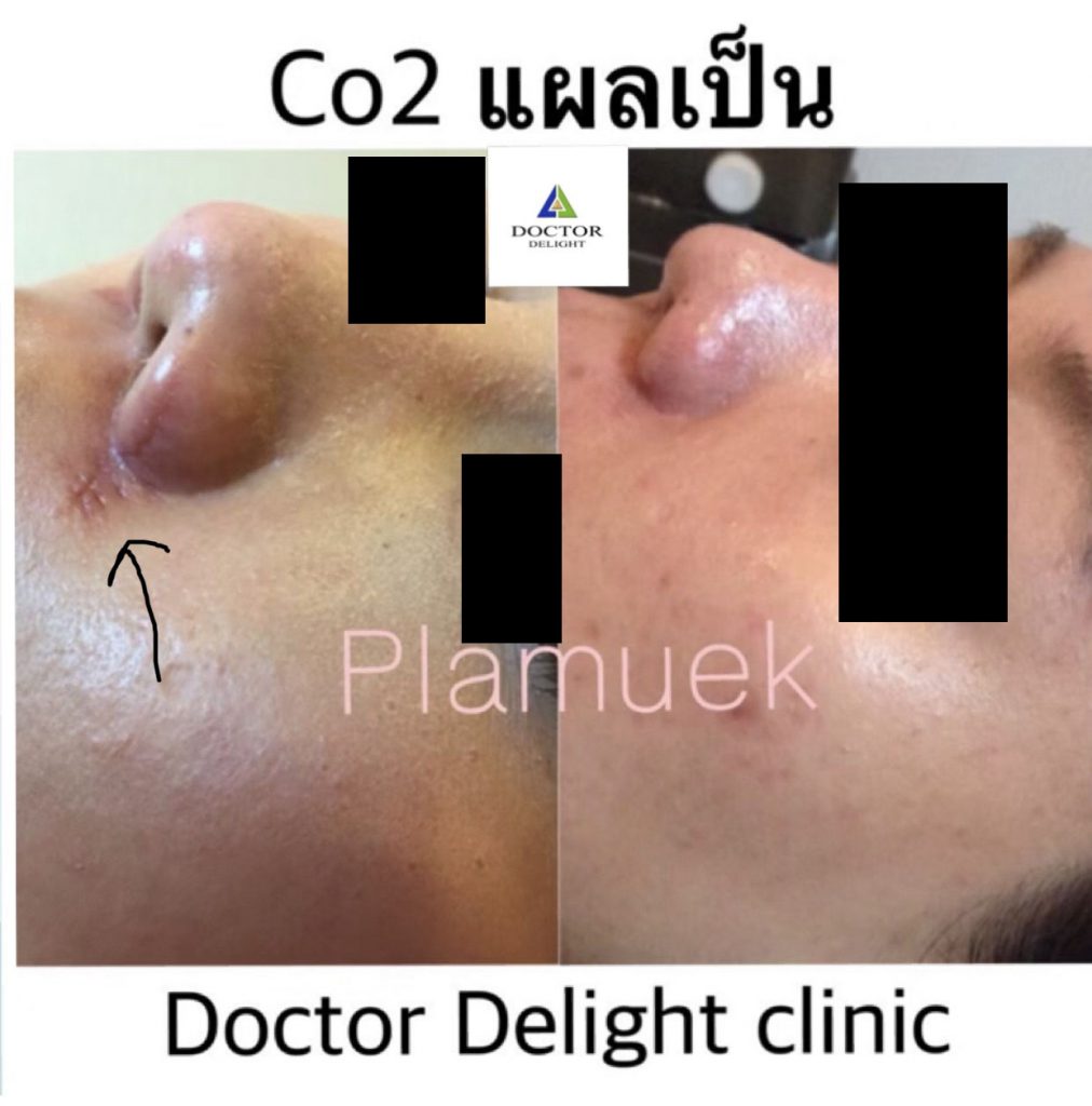 Dr. Delight Clinic คลินิกรักษาแผลเป็นนูน ปรับผิว ฟื้นฟูผิวให้มีสุขภาพดีขึ้นกว่าเดิม - 2