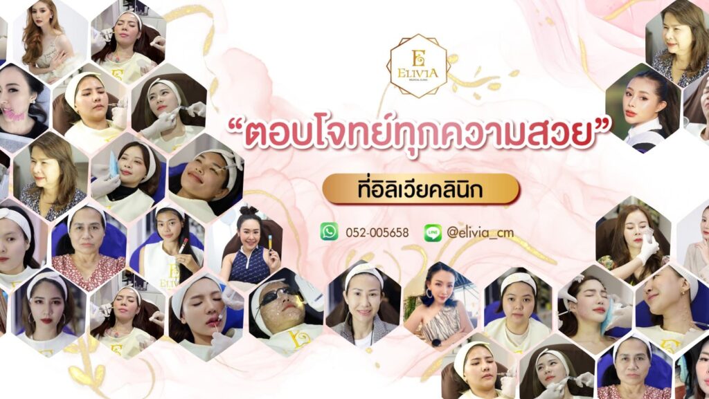 Elivia Clinic ทำอัลเทอร่าเชียงใหม่ ฟื้นฟู ยกกระชับผิว คืนความเยาว์วัยให้ดูเด่นชัดมากขึ้น