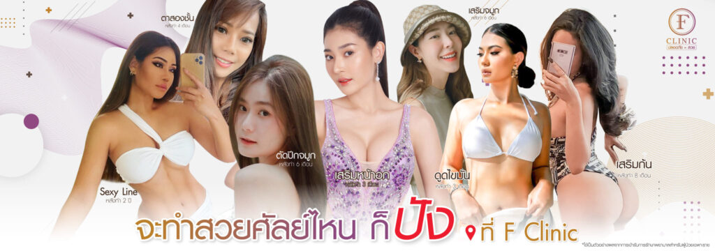 F Clinic บริการรับฉีด Belotero เพิ่มความสมดุลให้ผิวหน้าดูมีความโดดเด่นตามแบบที่ฝันเอาไว้