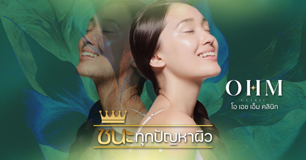 OHM Clinic คลินิกรับฉีด Belotero ปรับสมดุลของผิวหน้าให้ความรู้สึกระดับพรีเมียม