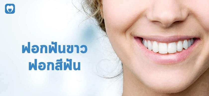 Care Dental Clinic รับฟอกสีฟัน เพิ่มความมั่นใจให้ทุกรอยยิ้ม ฟันขาวสะอาดดูแข็งแรงทุกซี่หลังการท