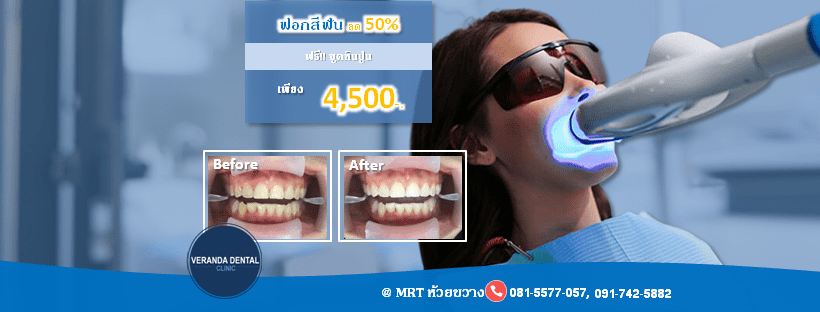 Veranda Dental Clinic รับฟอกสีฟัน มอบทุกความคุ้มค่า ฟอกสีฟัน ขัดฟัน ขูดหินปูน ครบจบในคอร์สเดียว