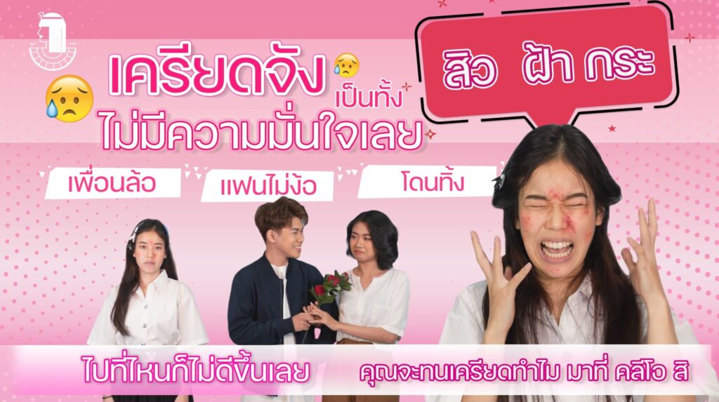 Cleo Clinic รับรักษาสิว เชียงใหม่ คลายทุกความกังวล สยบปัญหาของสิวบนใบหน้าให้หมดไป