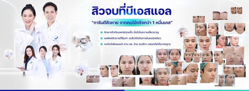 BSL Clinic รักษาสิวอักเสบกรุงเทพ การันตีทุกวิธีการเลือกใช้เครื่องมือ อุปกรณ์ที่ได้มาตรฐา