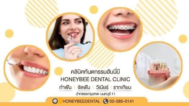 Honeybee Dental Clinic บริการรับขูดหินปูน กรุงเทพ ฟันขาวสะอาด ยิ้มสวยได้อย่างมั่นใจ