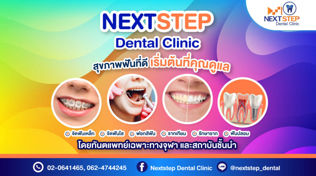 NextStep Dental Clinic คลินิกรับขูดหินปูน กรุงเทพ เติมเต็มรอยยิ้มขาวสะอาดสดใส สุขภาพฟันดูดีขึ้น