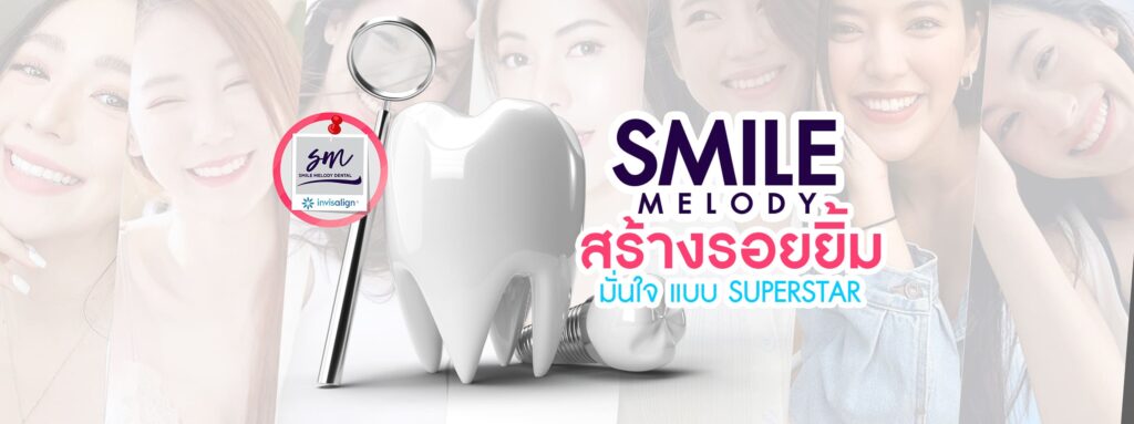 SM Dental Clinic คลินิกวีเนียร์ กรุงเทพ คืนรอยยิ้มขาวสะอาด ปลอดภัย เห็นผลเร็วไม่กระทบเหงือกและ